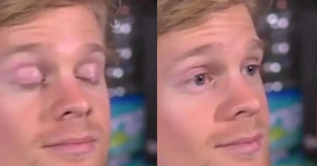 Blinking in Disbelief